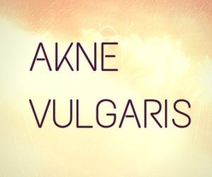 Akne Vulgaris